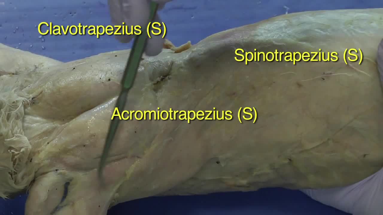 Cat Dissection, Muscular System