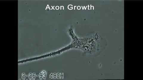 Axon growth & neuron degeneration (mercury exposure)