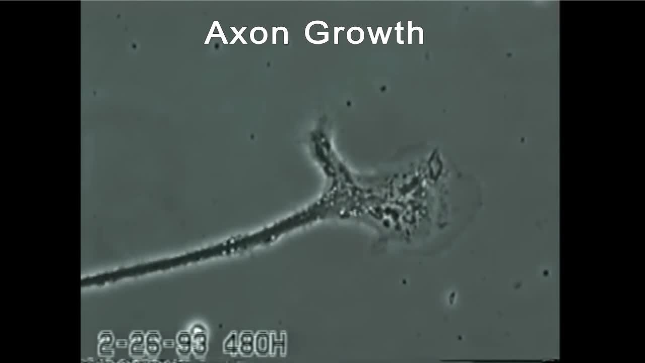 Axon growth & neuron degeneration (mercury exposure)