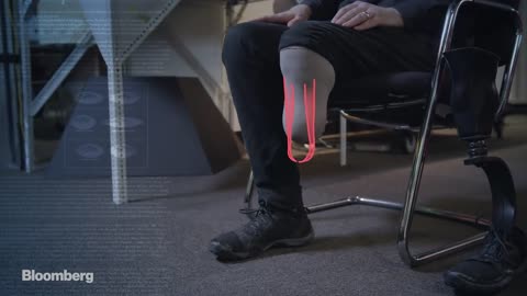 This MIT Engineer Built His Own Bionic Leg