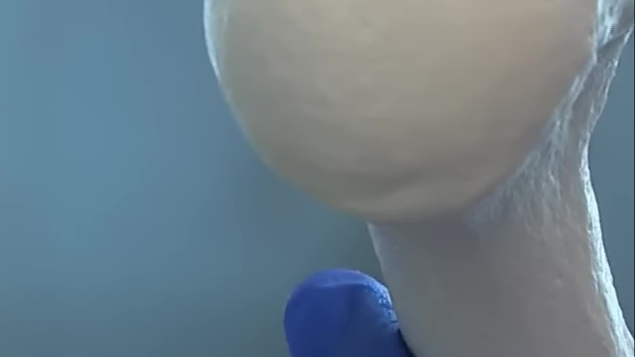 Revolutionary Breakthroughs in Cartilage Regeneration and Repair