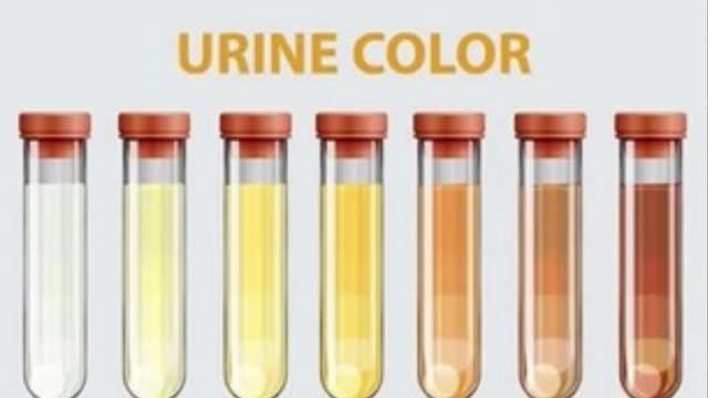 Different Pee color