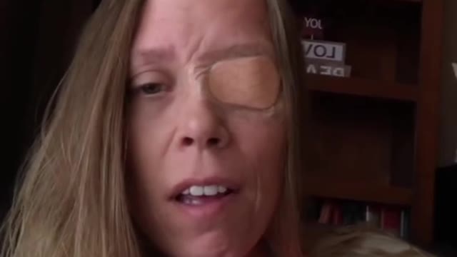 Canadian Woman Damaged By Covid-19 Shot - Bell’s Palsy