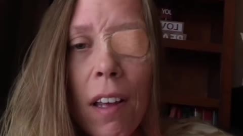 Canadian Woman Damaged By Covid-19 Shot - Bell’s Palsy