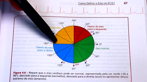 Dicas de ECG - qual o eixo normal do QRS