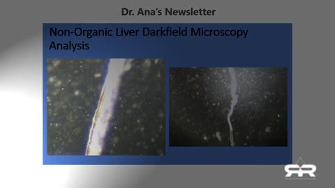 American Farmers To begin injecting livestock with MRNA shots this month