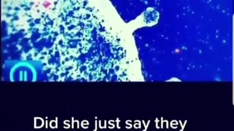 HIV ADDED?