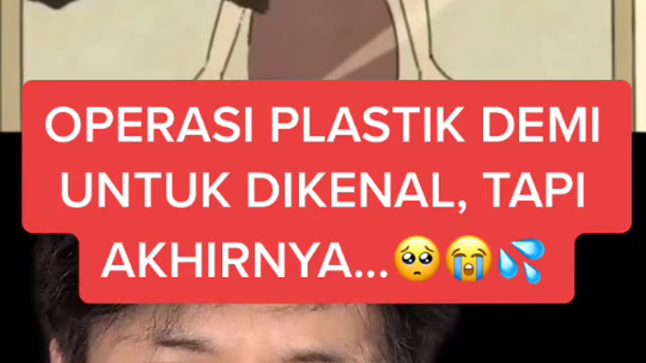 Operasi plastik untuk dikenal