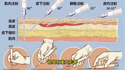 快樂激素「多巴胺」 理解疾病及神經多元性