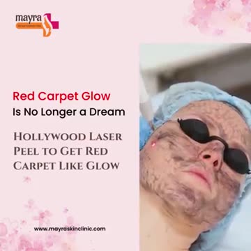 Dreaming Of Red Carpet Like Glow? Try Hollywood Laser Peel And Glow Like A Hollywood Star