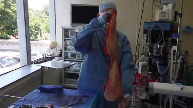 360 Body Lift after Extreme Weight Loss
