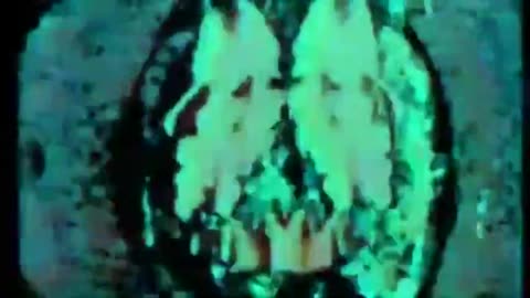 CIA Mission Mind Control (1979) Drugs, Sex, Torture, Spying, Murder, The Russians And Worse