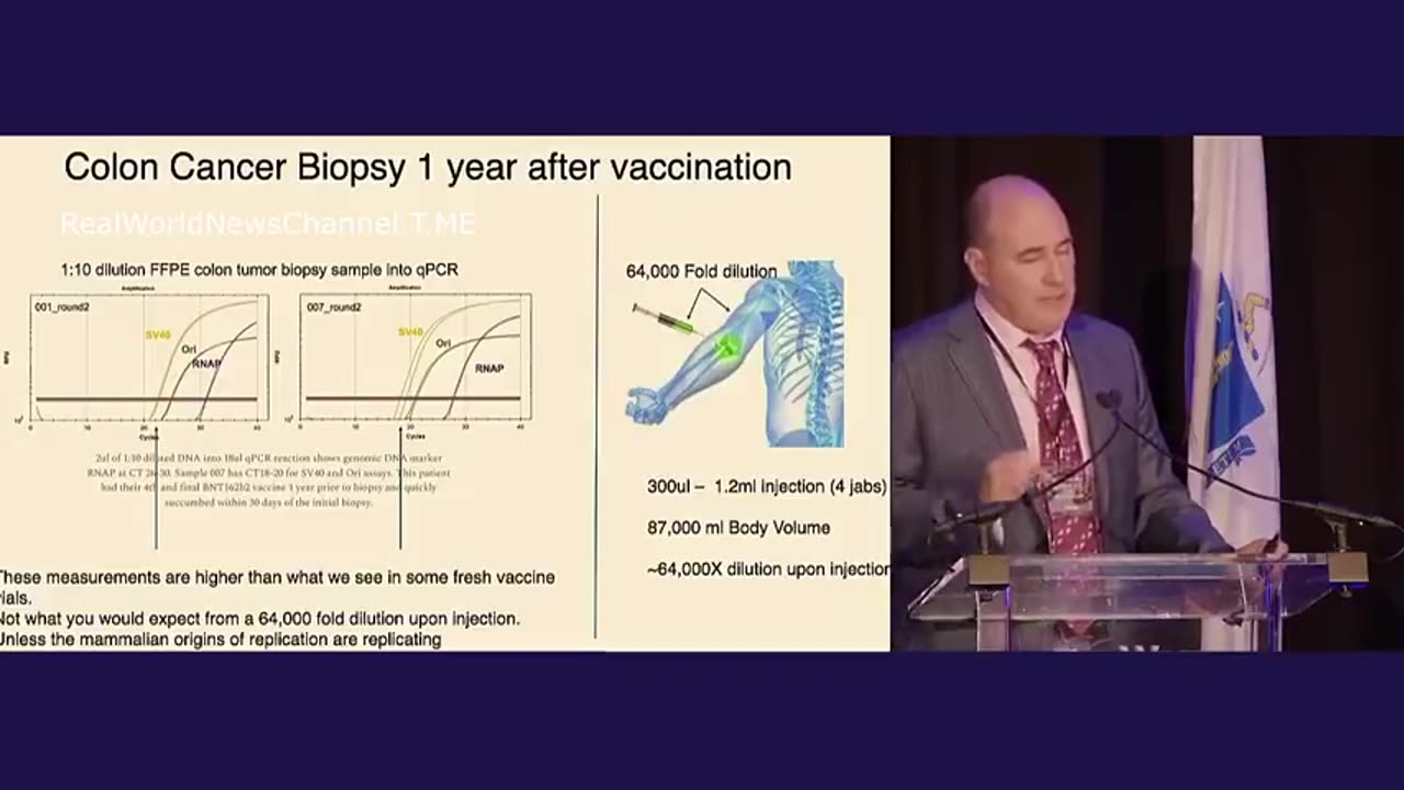 Shocking Colon Cancer Biopsy 1 Year After Vaccination