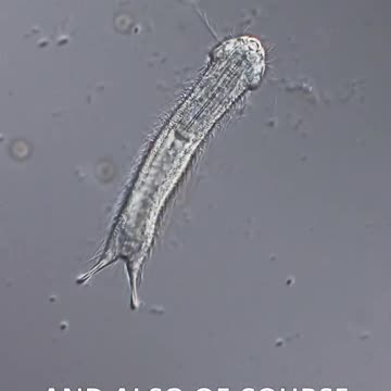 GASTROTRICH under the microscope