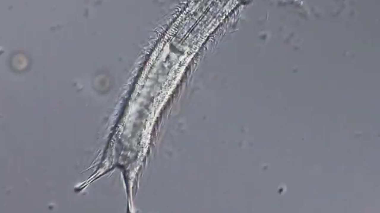 GASTROTRICH under the microscope