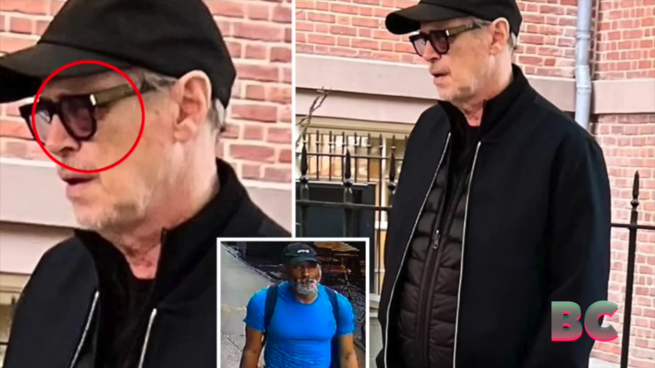 Steve Buscemi spotted with black eye, swollen face after random NYC attack