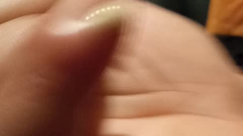 Pus de baixo da unha furando com agulha