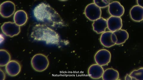 Blick ins Blut | Blut-Bilder