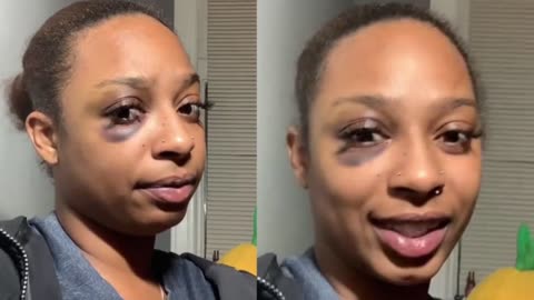 Black Woman Speaks On Pookie Giving Her A Black Eye