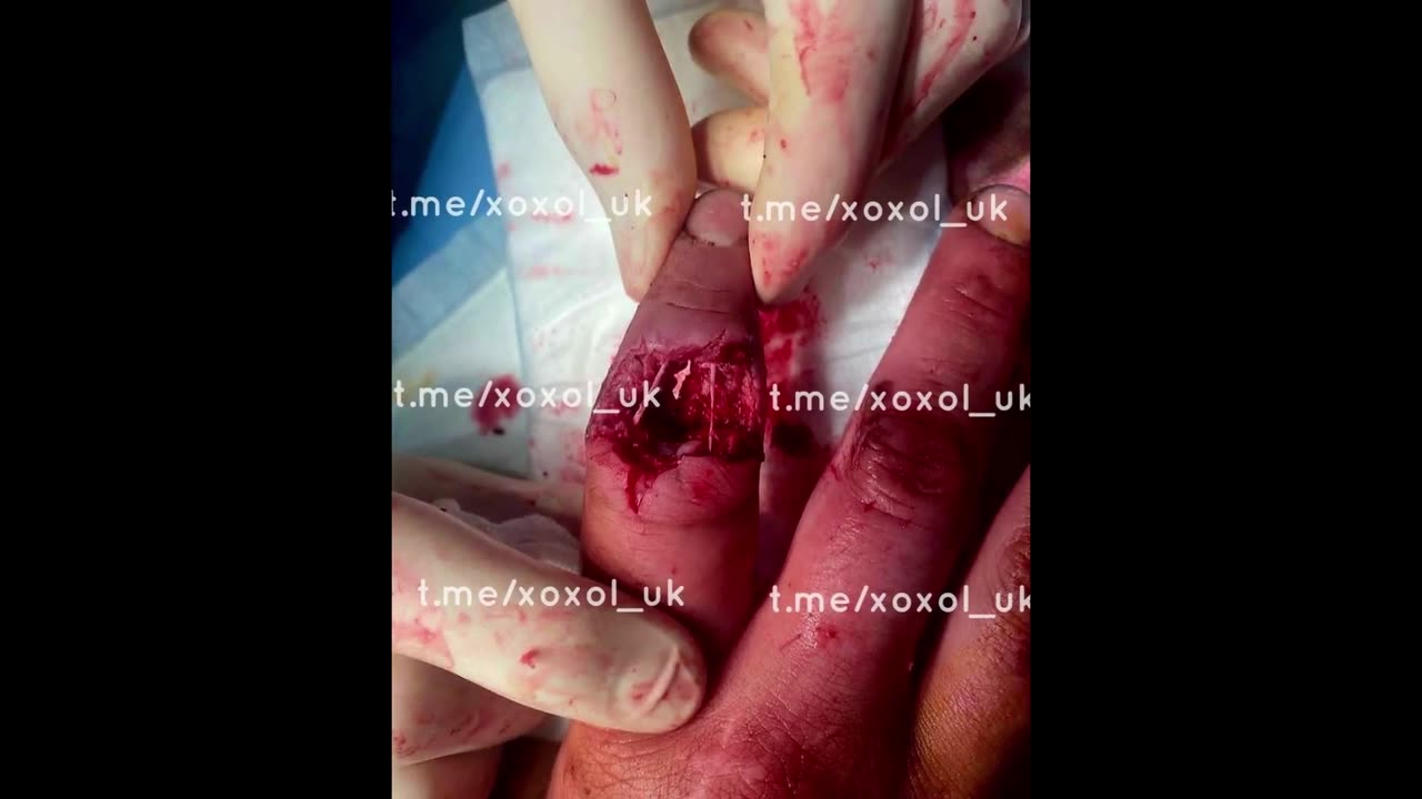 Graphic War Video 18++++++ Warning!!!!!!