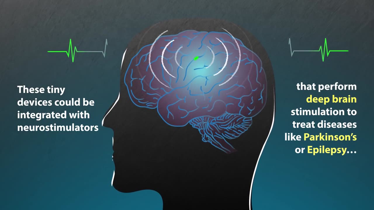 Wireless System Can Power Devices Inside The Body🧍‍♂️🧍‍♀️👀🤬