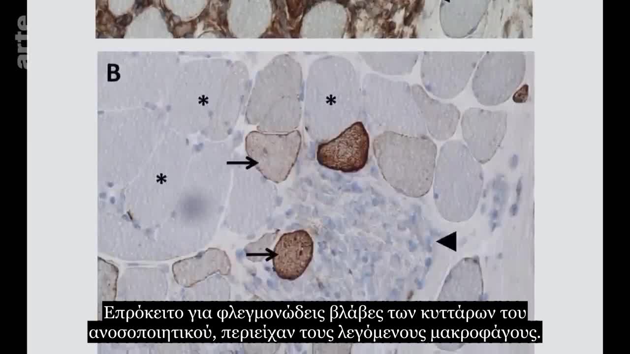Εμβολιασμός - Όλη η ιστορία