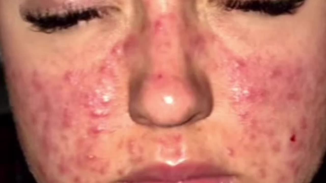 Serum That Changed My Entire Skin