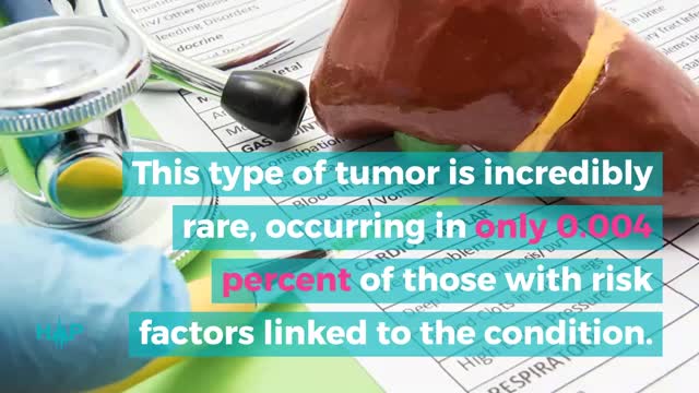 Causes And Risks Of Hepatic Adenoma