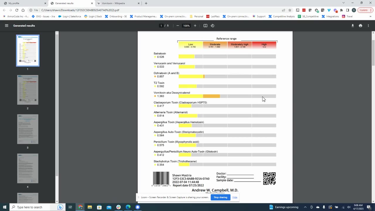 Regressive Autism and Vomitoxin / DON