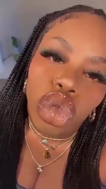 What the hell is she allergic to?