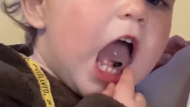 Parent Pulls Tiny Pest From Toddler's Mouth