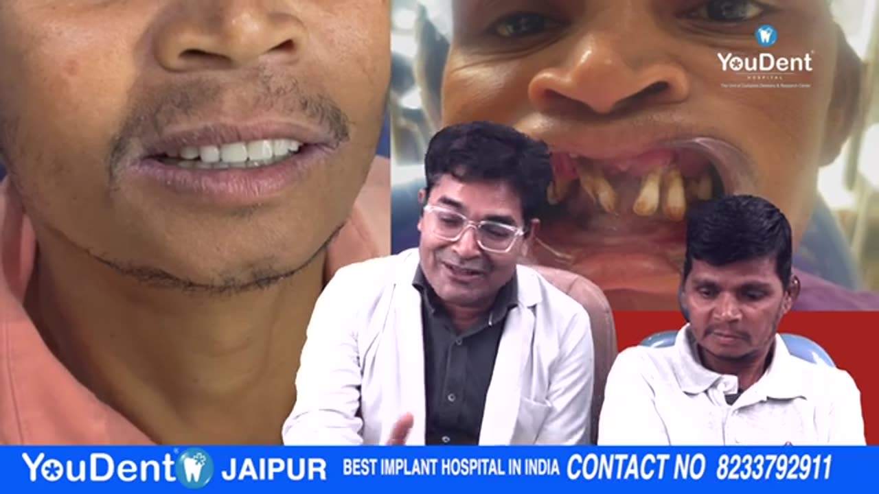 Best Dental Implant in India