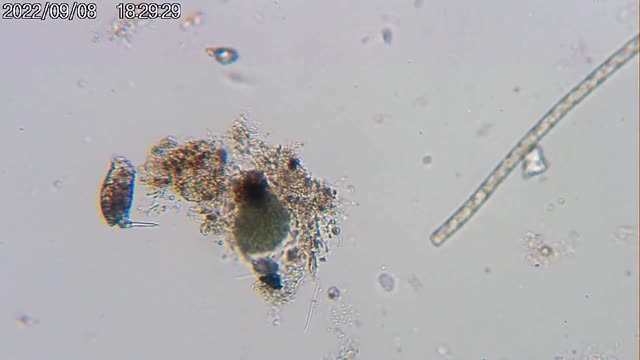 Follow the rotifier (Colurella adriatica), 2022-09-08