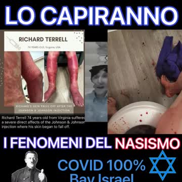 Se non lo capiscono così allora sono parecchio ritardati. COVID