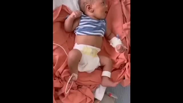 Covid-19 Vaccine Adverse reactions