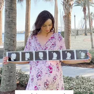 This little boy has defied all odds!