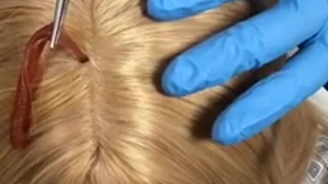 He pulled it from her scalp!…