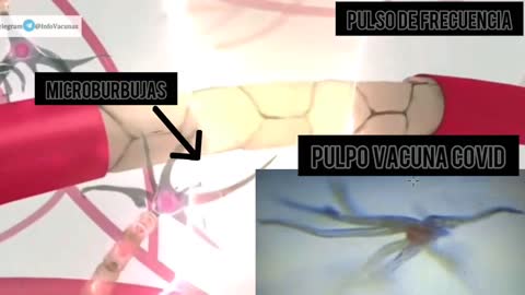 Graphene bubbles