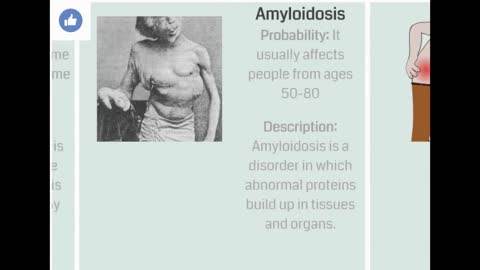 Probability comparison Autoimmune Diseases