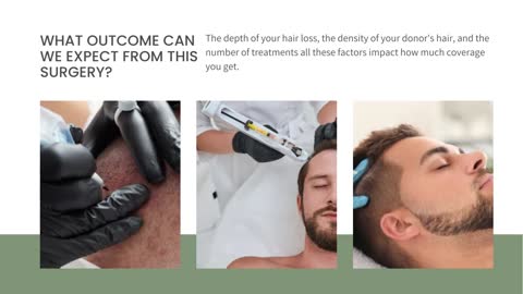 Hair Transplant: How Much Time It Can Take For Surgery | AHS