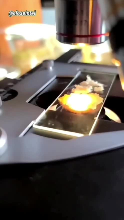 Mc Donalds Morgellon