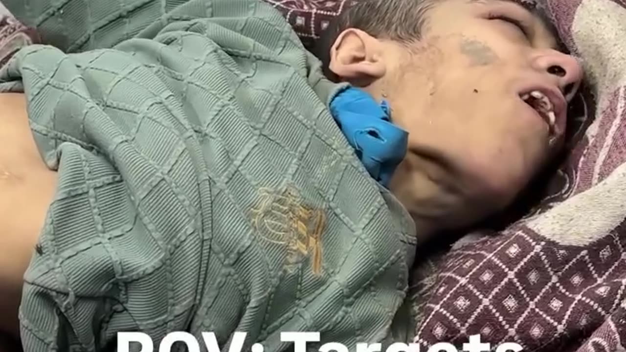 A child with Cerebral palsy (CP) arrived to the ER after Israeli Air strike