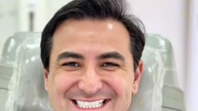 Hair transplant FUE technique