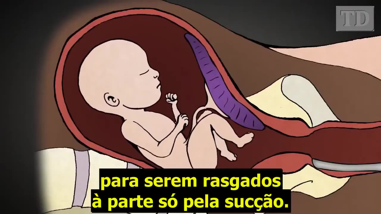 Diga não ao aborto | Dr. Anthony Levantino