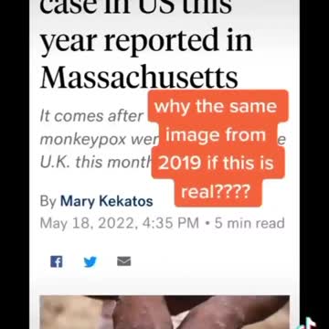 Sidde effect Vaccine