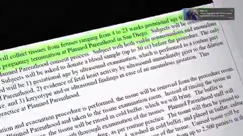 New emails: Planned Parenthood with @UCSanDiego to sell aborted fetuses to conduct experiments on