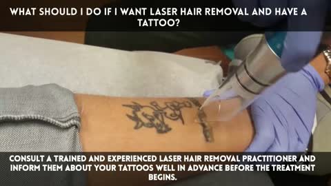 Does Laser Hair Removal Damage Tattoos?