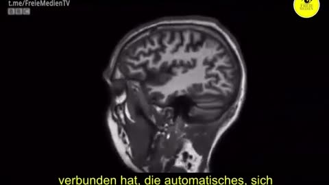 Junk food changes our brains – and makes us stupid!