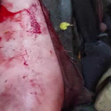 GRAPHIC: Ukrainians against Mercenaries in friendly fire for 2 hours, heave losses on both sides