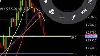 Update 2 | How to trade Forex Right | My Forex Journey 466+ PIPS